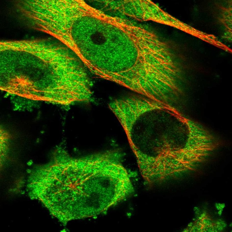 Staining of human cell line U-251 MG shows localization to nucleoplasm & cytosol.
