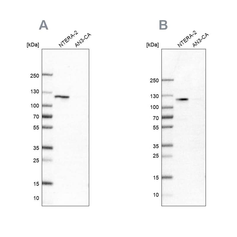 <b>Independent Antibodies Validation. </b>Analysis using NBP1-89662 (A) shows similar pattern to independent antibody NBP2-55047 (B).