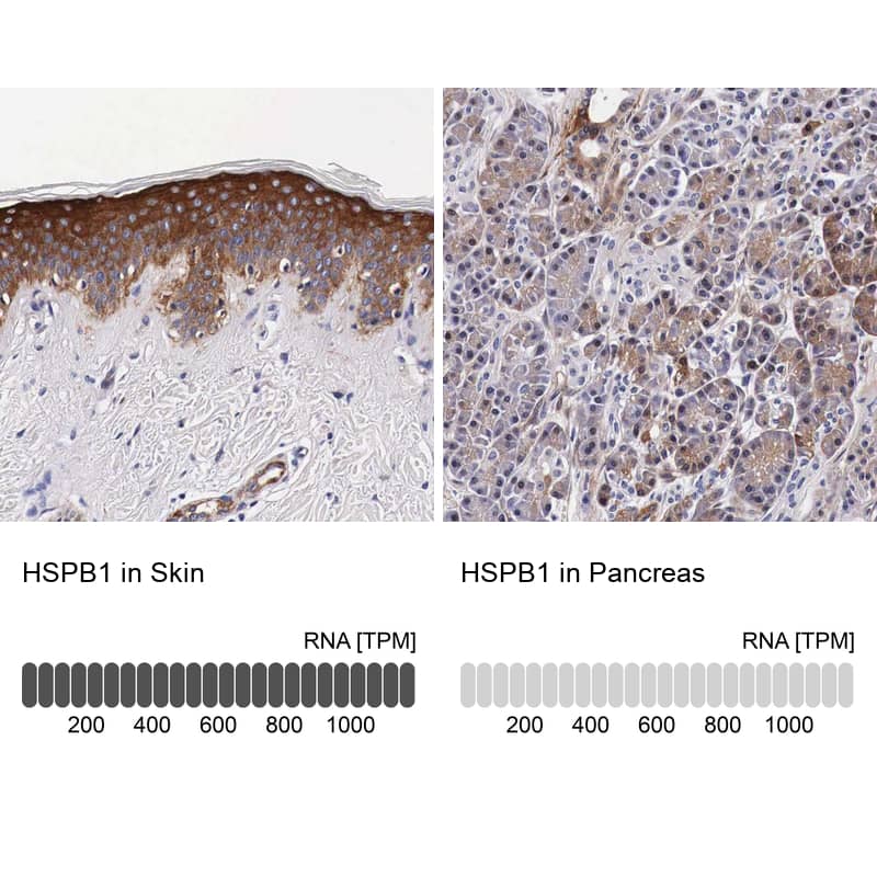 Analysis in human skin and pancreas tissues using Anti-HSPB1 antibody. Corresponding HSPB1 RNA-seq data are presented for the same tissues.