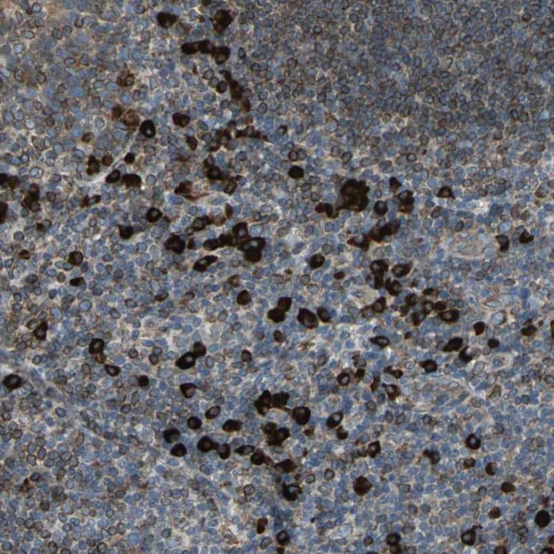 Staining of human tonsil shows strong cytoplasmic positivity in non-germinal center cells.