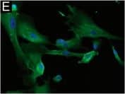 Immunocytochemistry/ Immunofluorescence: NG2/MCSP Antibody [NBP1-89682] - Immunofluorescence (IF) analysis of NG2/CSPG4 expression in glioblastoma (GB)-derived human cell lines. IF of a GB-derived neurosphere cell line for (A) NG2/CSPG4 (green), original magnification (OM) ×200; (B) Nestin (red), OM ×200; (C) MSel1 (red), OM ×200; (D) Notch-2 (green), OM ×200. IF staining of an adherent cell line for (E) NG2/CSPG4 (green), OM ×400; (F) GFAP (green), OM ×400; (G)  beta -III Tubulin (red), OM ×200; (H) Galactocerebroside C (red), OM ×200. Nuclei were counterstained with DAPI (blue). DAPI, 4′,6-diamidino-2-phenylindole. Image collected & cropped by CiteAb from the following publication (//pubmed.ncbi.nlm.nih.gov/32599896), licensed under a CC-BY license. Not internally tested by Novus Biologicals.