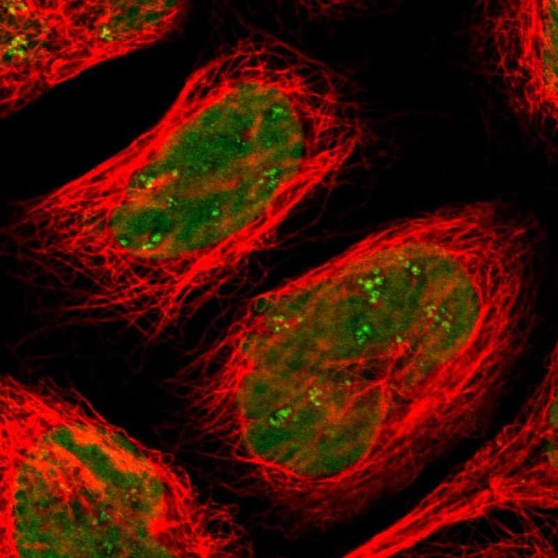 Staining of human cell line A-431 shows localization to nucleus & nucleoli fibrillar center.