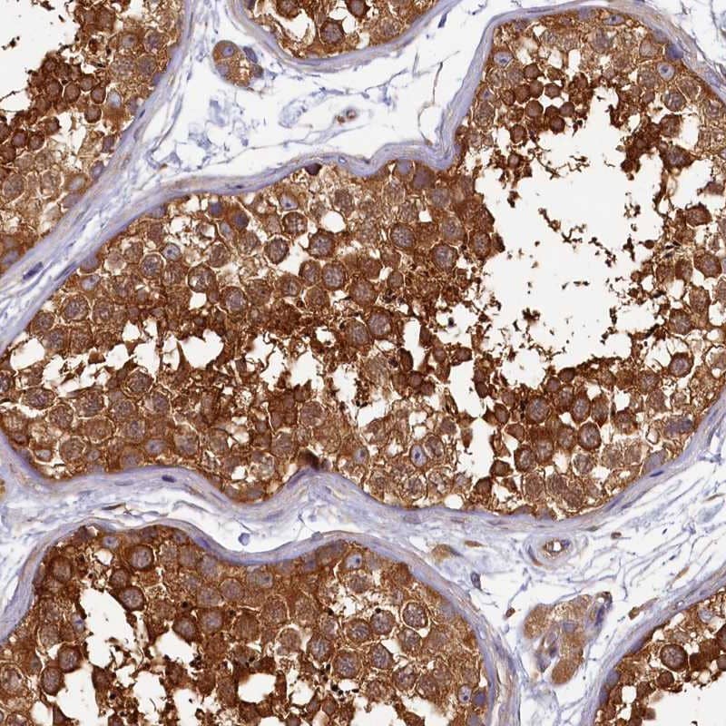 Staining of human testis shows strong cytoplasmic positivity in cells in seminiferus ducts.