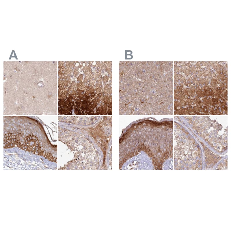 <b>Orthogonal Strategies Validation. </b>Staining of human cerebral cortex, liver, skin and testis HPA038547 (A) shows similar protein distribution across tissues to independent antibody HPA038548 (B).