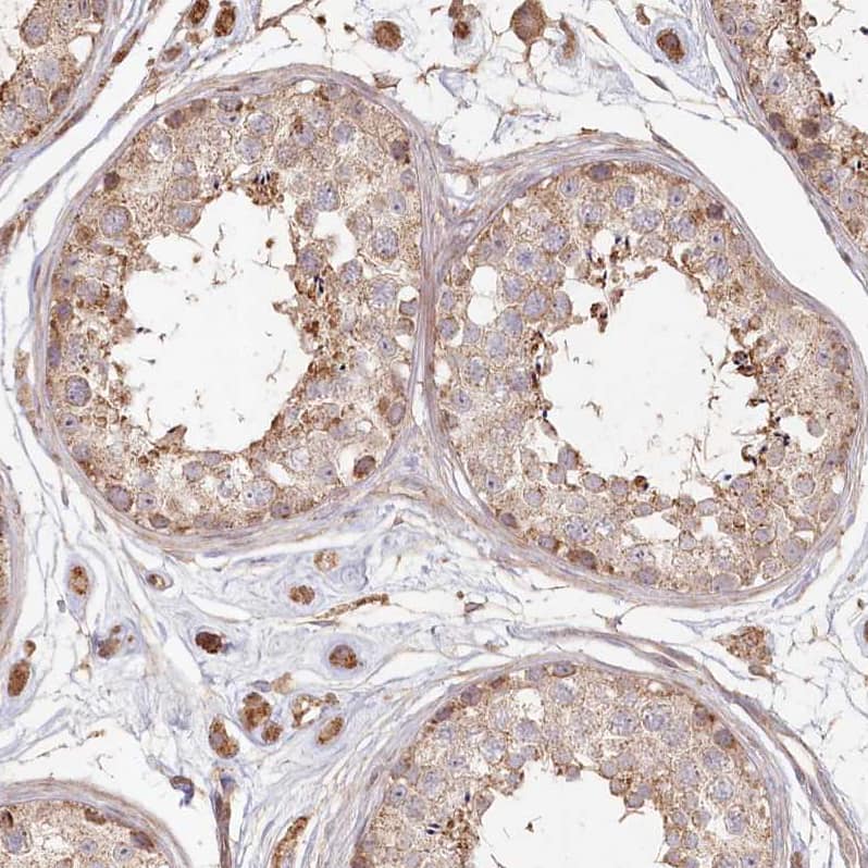 Staining of human testis shows moderate cytoplasmic positivity.