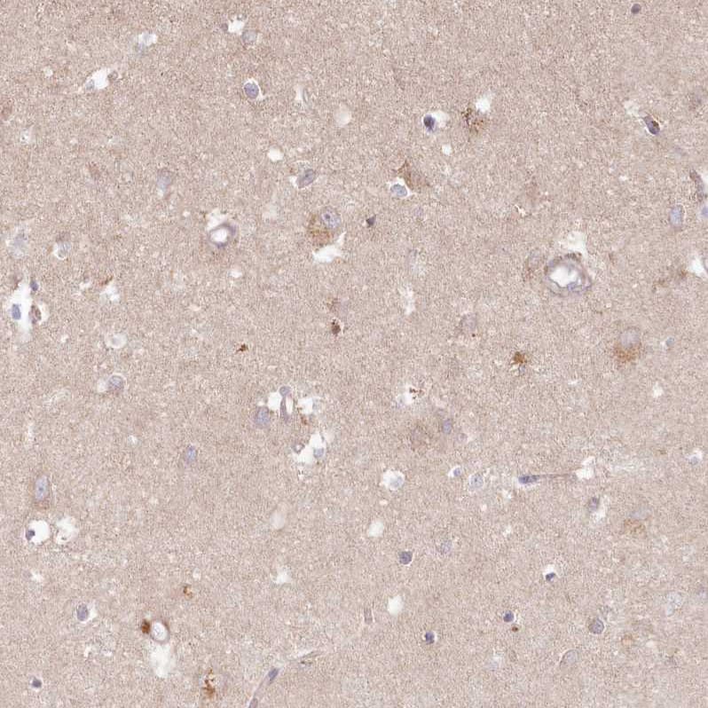 Staining of human cerebral cortex shows weak cytoplasmic positivity in neurons.