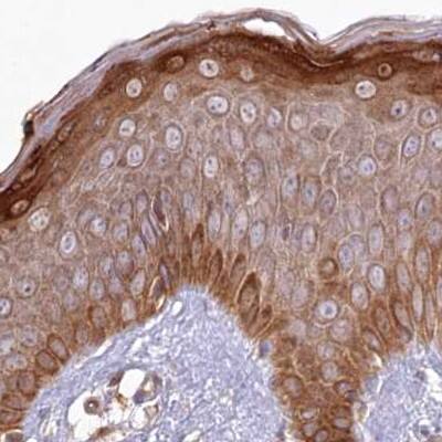 Staining of human skin.