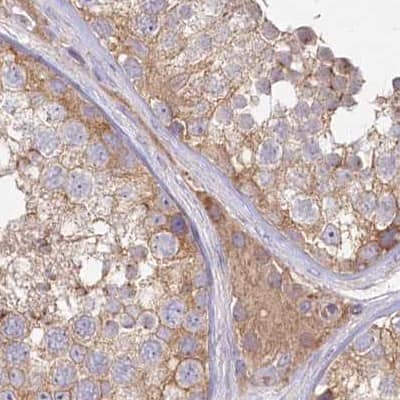 Staining of human testis.