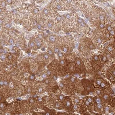 Staining of human liver.