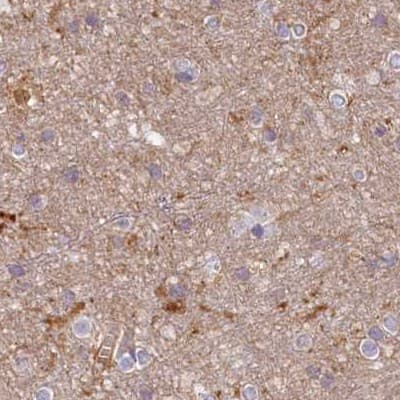 Staining of human cerebral cortex.