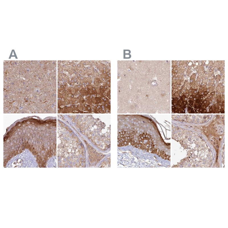 <b>Orthogonal Strategies Validation. </b>Staining of human cerebral cortex, liver, skin and testis HPA038548 (A) shows similar protein distribution across tissues to independent antibody HPA038547 (B).