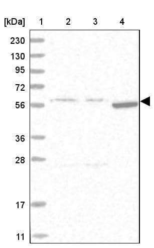 Lane 1: Marker [kDa] 230, 130, 95, 72, 56, 36, 28, 17, 11Lane 2: Human cell line RT-4Lane 3: Human cell line U-251MG spLane 4: Human plasma (IgG/HSA depleted)