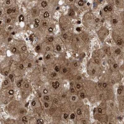 Staining of human liver.