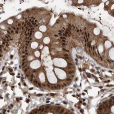 Staining of human colon.