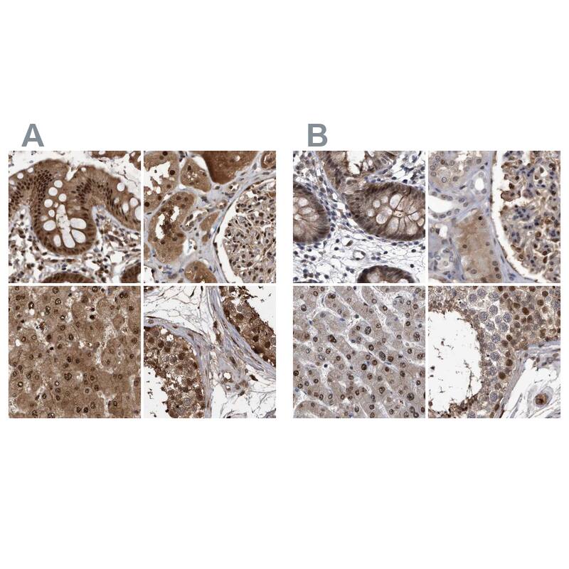Staining of human colon, kidney, liver and testis HPA029718 (A) shows similar protein distribution across tissues to independent antibody HPA029720 (B).