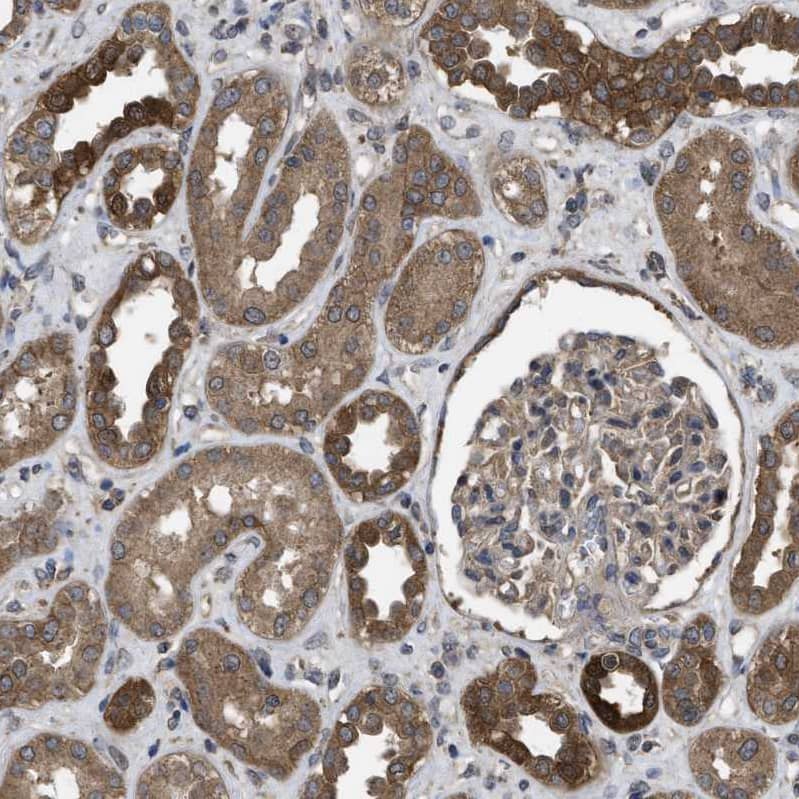 Immunohistochemistry-Paraffin Frizzled-6 Antibody - BSA Free