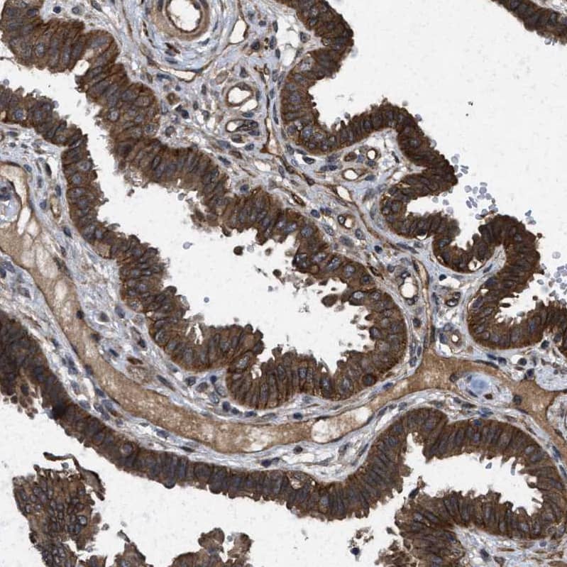 Staining of human Fallopian tube shows strong cytoplasmic and membranous positivity in glandular cells.
