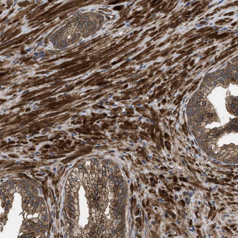 Staining of human prostate shows strong cytoplasmic positivity in smooth muscle cells.