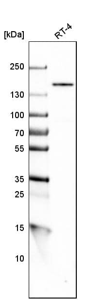 Analysis in human cell line RT-4.