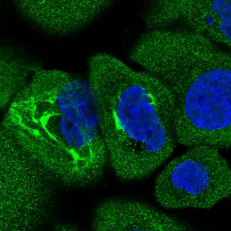 Staining of human cell line A-431 shows positivity in cytoplasm, intermediate filaments & nucleus but excluded from the nucleoli.