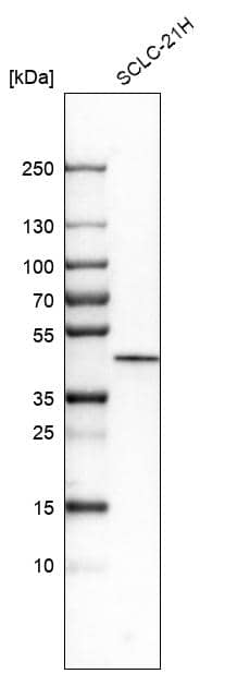 Analysis in human cell line SCLC-21H.