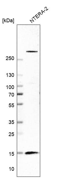 Analysis in human cell line NTERA-2.