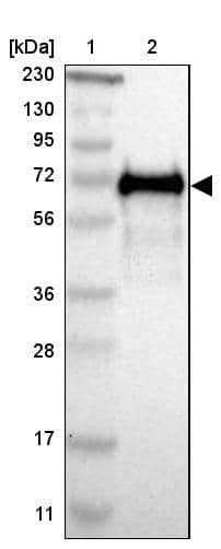 Lane 1: Marker [kDa] 230, 130, 95, 72, 56, 36, 28, 17, 11Lane 2: Human cell line RT-4