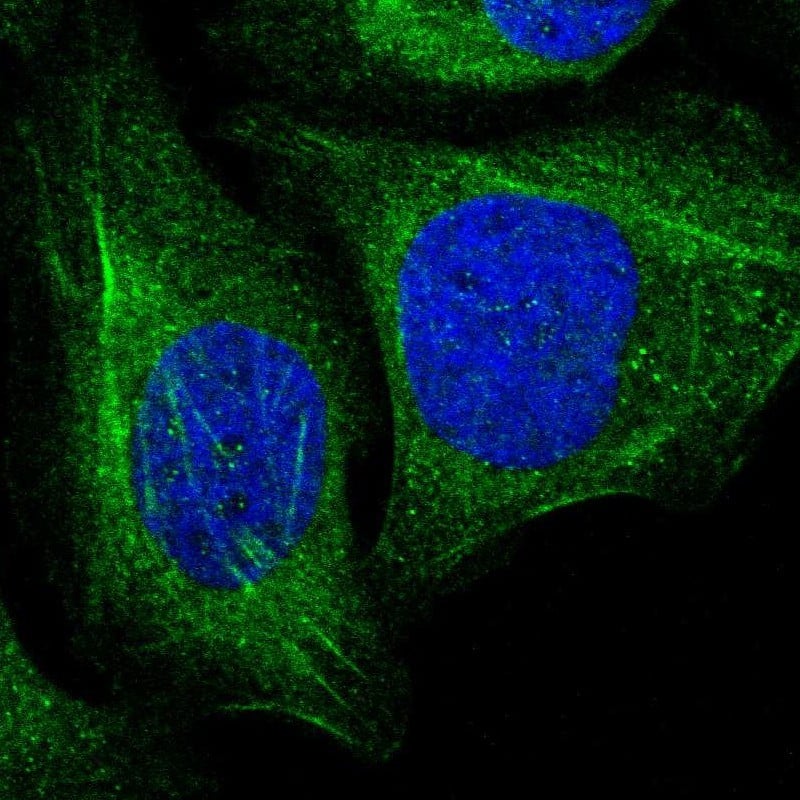 Immunocytochemistry/ Immunofluorescence transgelin 2 Antibody - BSA Free