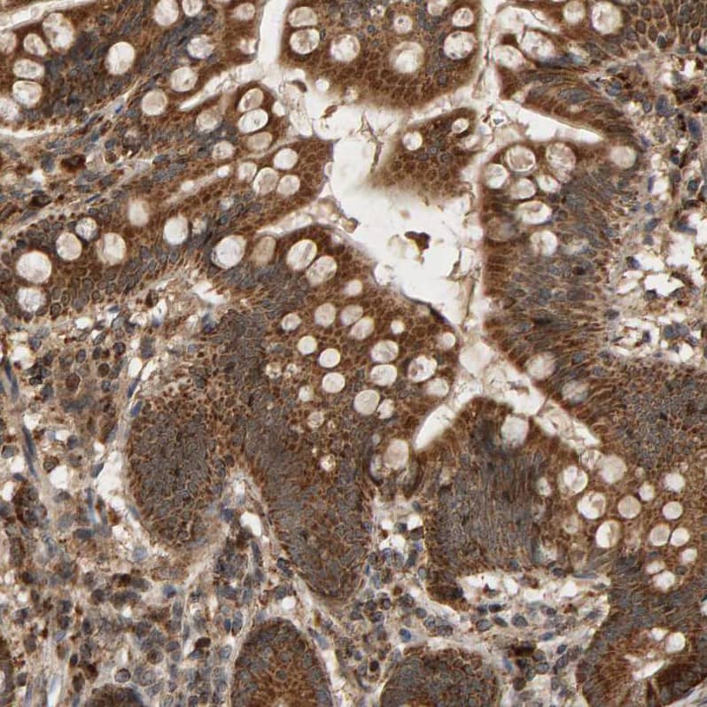 Staining of human small intestine shows strong granular cytoplasmic positivity in glandular cells.