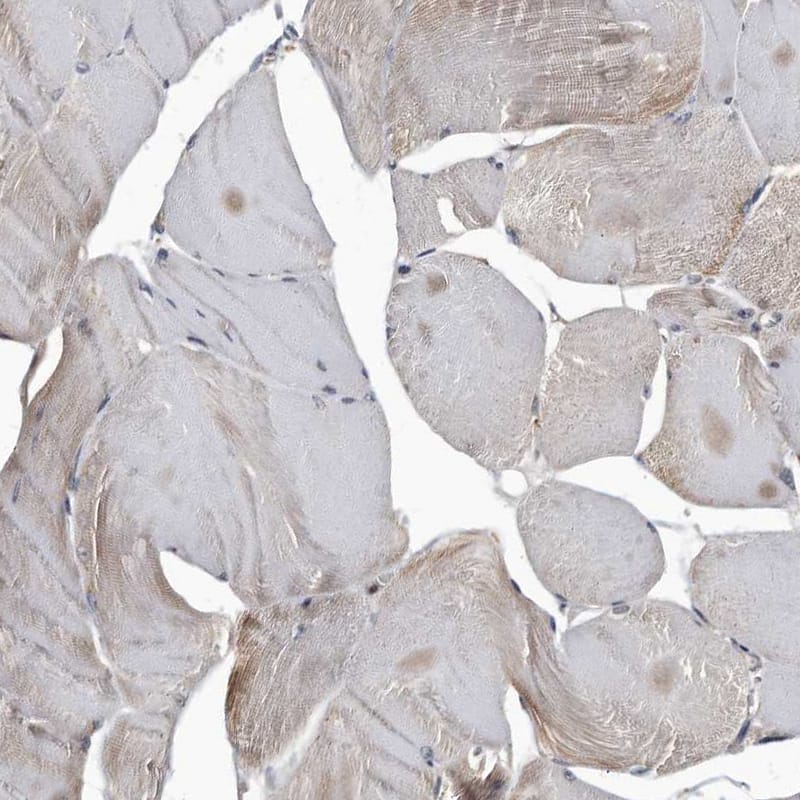 Staining of human skeletal muscle shows only very weak positivity in striated muscle fibers as expected.