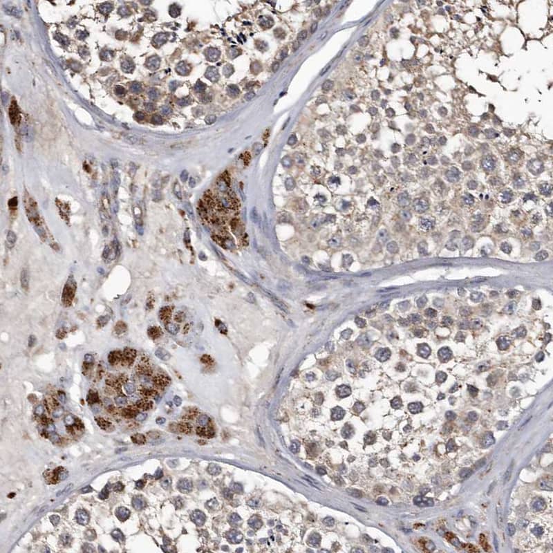 Staining of human testis shows strong granular cytoplasmic positivity in Leydig cells.