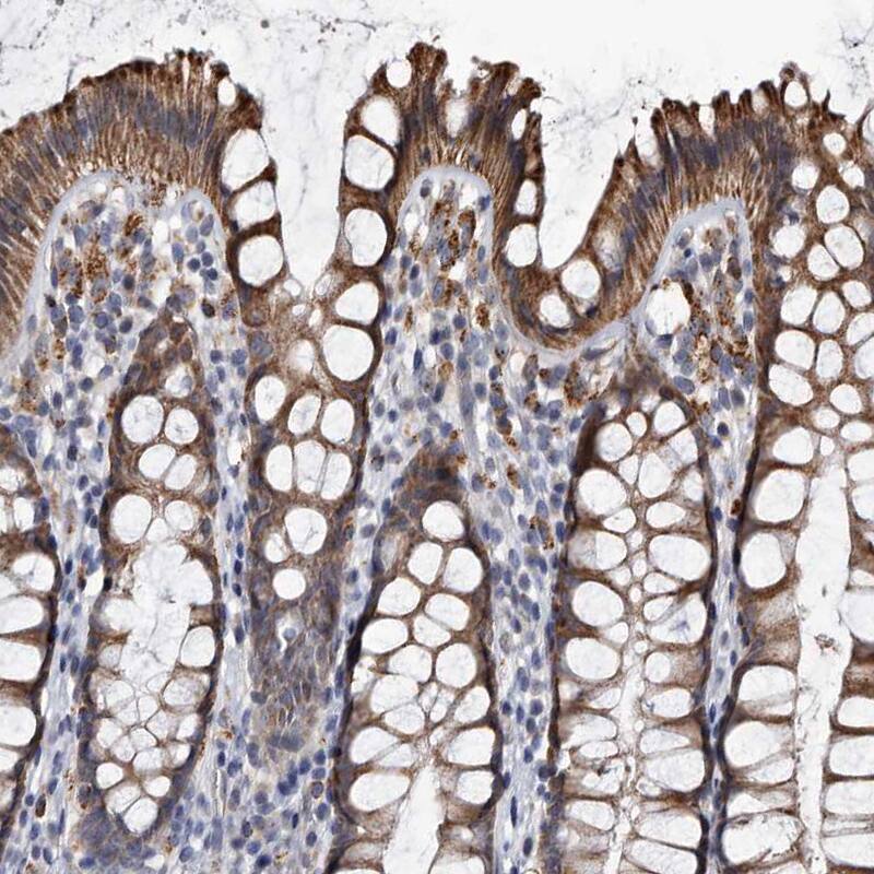 Staining of human rectum shows moderate granular cytoplasmic positivity in glandular cells.