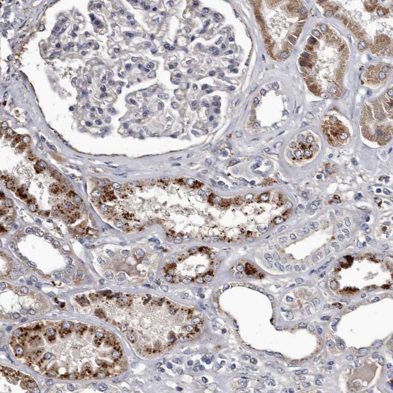 Staining of human kidney shows moderate to strong granular cytoplasmic positivity in cells in tubules.