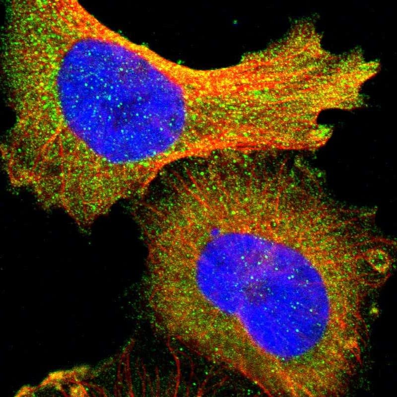 Staining of human cell line U-251 MG shows localization to cytosol.