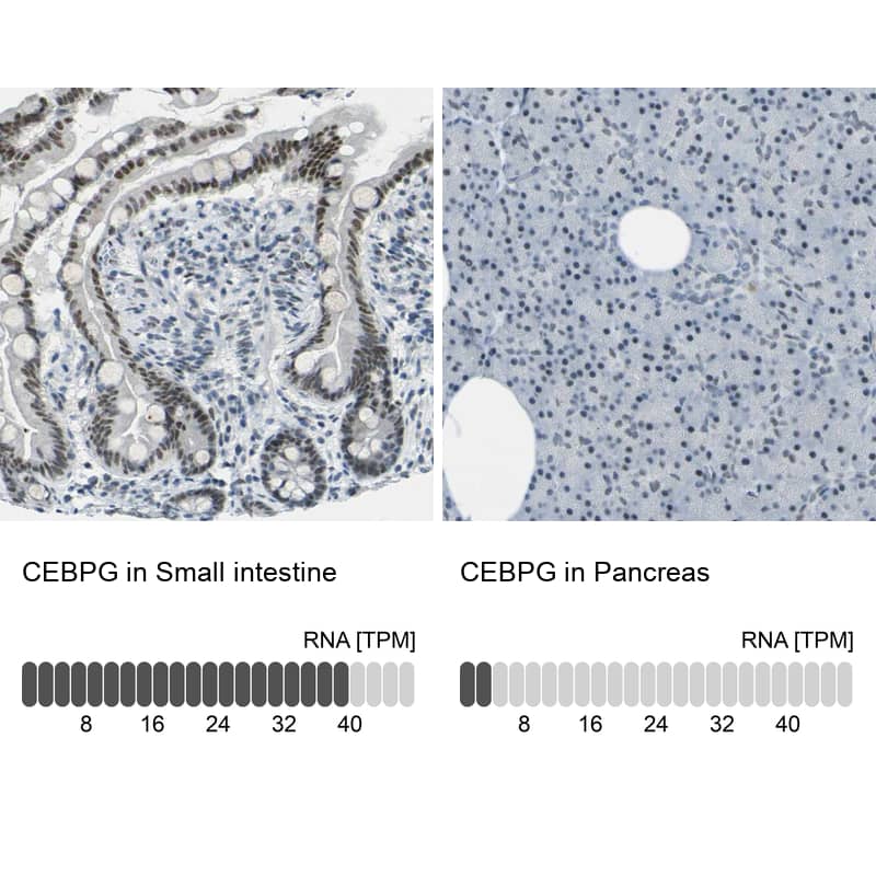 Analysis in human small intestine and pancreas tissues.