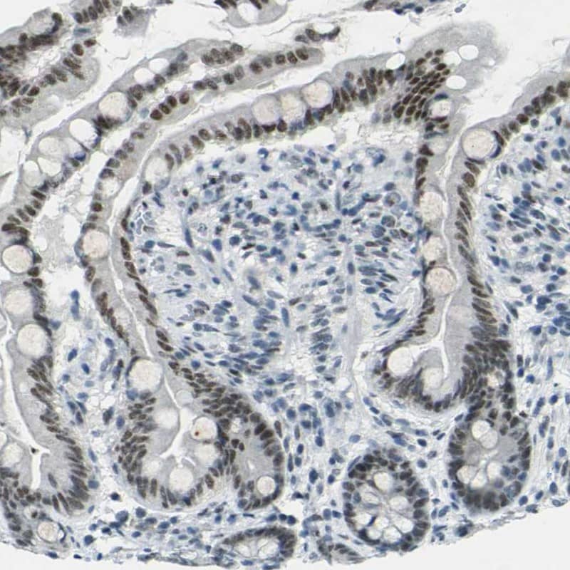 Staining of human small intestine shows high expression.