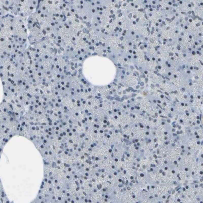 Staining of human pancreas shows low expression as expected.