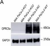 Western Blot: GPRC5A/RAI3 Antibody [NBP1-89743] - Influence of GPRC5a knockout on the proliferation & migration ability in MIA PaCa-2 & TB32047 cells. (A–D) Western blot & sequencing results showing the GPRC5a knocked out in MIA PaCa-2-KO1/2 & TB32047-KO1/2 (Red highlight area means the different part in comparison of sequencing sequence). (E,F): The knockout of GPRC5a inhibited the proliferation ability of MIA PaCa-2 & TB32047 cells. (G,H) GPRC5a knockout inhibited the migration ability of MIA PaCa-2 (G) & TB32047 cells (H). * p-value < 0.05. Image collected & cropped by CiteAb from the following publication (//pubmed.ncbi.nlm.nih.gov/29949874), licensed under a CC-BY license. Not internally tested by Novus Biologicals.