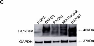 Western Blot: GPRC5A/RAI3 Antibody [NBP1-89743] - GPRC5a expression levels in normal pancreas & PaCa (PAAD) tissue & cell lines. (A,B) The data-mining analysis showed that GPRC5a was significantly upregulated in PaCa (PAAD) samples with an association of increased expression in higher malignant tumor stages (p < 0.05). (C,D) The Western blot & qPCR results showed that the basic protein-level expression of GPRC5a in PaCa cell lines was higher than that in the HPDEE6E7 pancreas cell line. (E) Immunofluorescence assay showed upregulated expression of GPRC5a in PaCa cell lines (200×). The error bars were from multiple samples (n) measurement results (A,B) or three experimental measurements (C,D). * p-value < 0.05. Image collected & cropped by CiteAb from the following publication (//pubmed.ncbi.nlm.nih.gov/29949874), licensed under a CC-BY license. Not internally tested by Novus Biologicals.