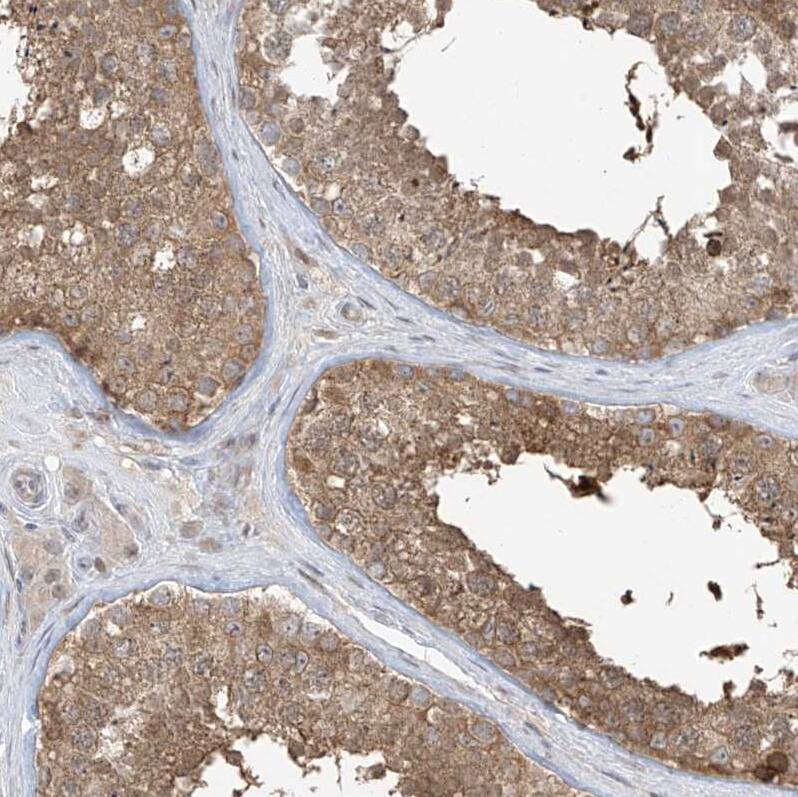 Staining of human testis shows moderate cytoplasmic positivity in cells in seminiferous ducts.