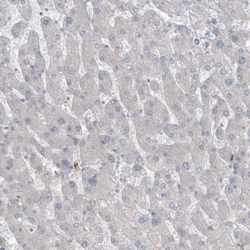 Staining of human liver shows no cytoplasmic positivity in hepatocytes as expected.