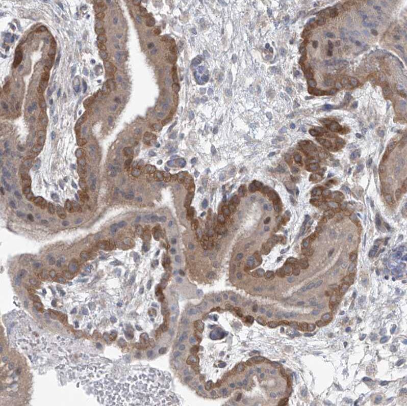 Staining of human placenta shows moderate cytoplasmic positivity in trophoblastic cells.
