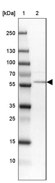 Lane 1: Marker [kDa] 250, 130, 100, 70, 55, 35, 25, 15, 10Lane 2: Human cell line MOLT-4