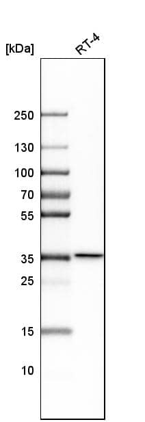 Analysis in human cell line RT-4.