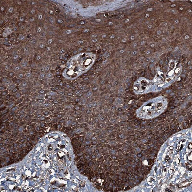 Immunohistochemistry-Paraffin GNIP Antibody - BSA Free