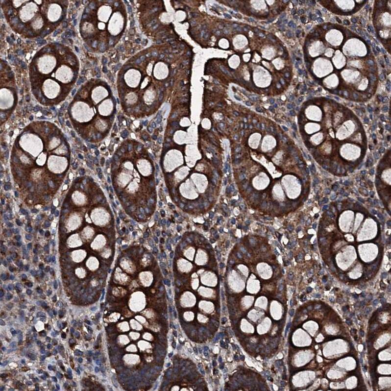 Staining of human colon shows strong cytoplasmic positivity in glandular cells.