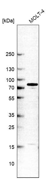 Analysis in human cell line MOLT-4.