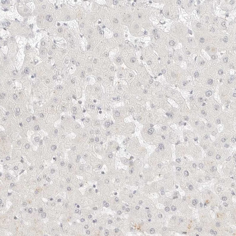 Staining of human liver shows no membranous positivity in hepatocytes as expected.