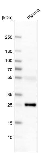 Analysis in human plasma.