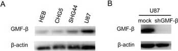 Western Blot: GMF-beta Antibody [NBP1-89755] - Tubulogenesis of human U87 glioblastoma cells is inhibited by GMF-beta  knockdownA. Protein levels of GMF-beta  in human glial cell line (HEB) & human glioma cell lines of the different grades (CHG5, SHG44, U87). B. Assessment of GMF-beta  knockdown in U87 cells by western blotting. C. Tube formation by U87 mock cells (left panel); impaired tube formation by U87-shGMF-beta  cells (right panel). Inspection under a phase contrast fluorescent microscope (× 100). D. Quantified tubulogenesis of U87 mock cells & U87-shGMF-beta  cells by pattern recognition system (left panel) & branch point counting system (right panel).*** indicates significant difference with P < 0.001. Image collected & cropped by CiteAb from the following publication (//pubmed.ncbi.nlm.nih.gov/26515590), licensed under a CC-BY license. Not internally tested by Novus Biologicals.